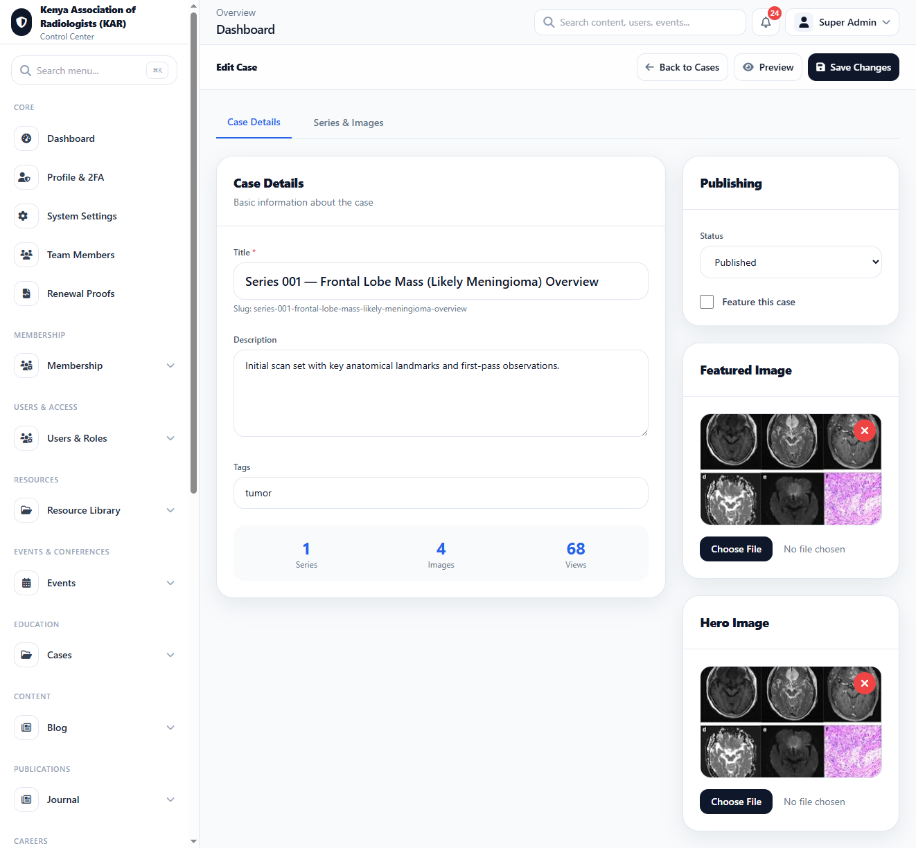 Case Add interface